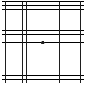 Amsler Grid Recording Vision - Optometry Supplies and Tests – Stag Medical