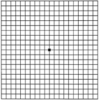 Amsler grid normally looks like