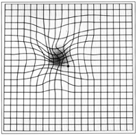 Amsler grid might look to someone with AMD