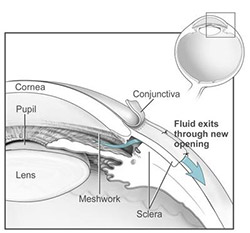 Optic Nerve